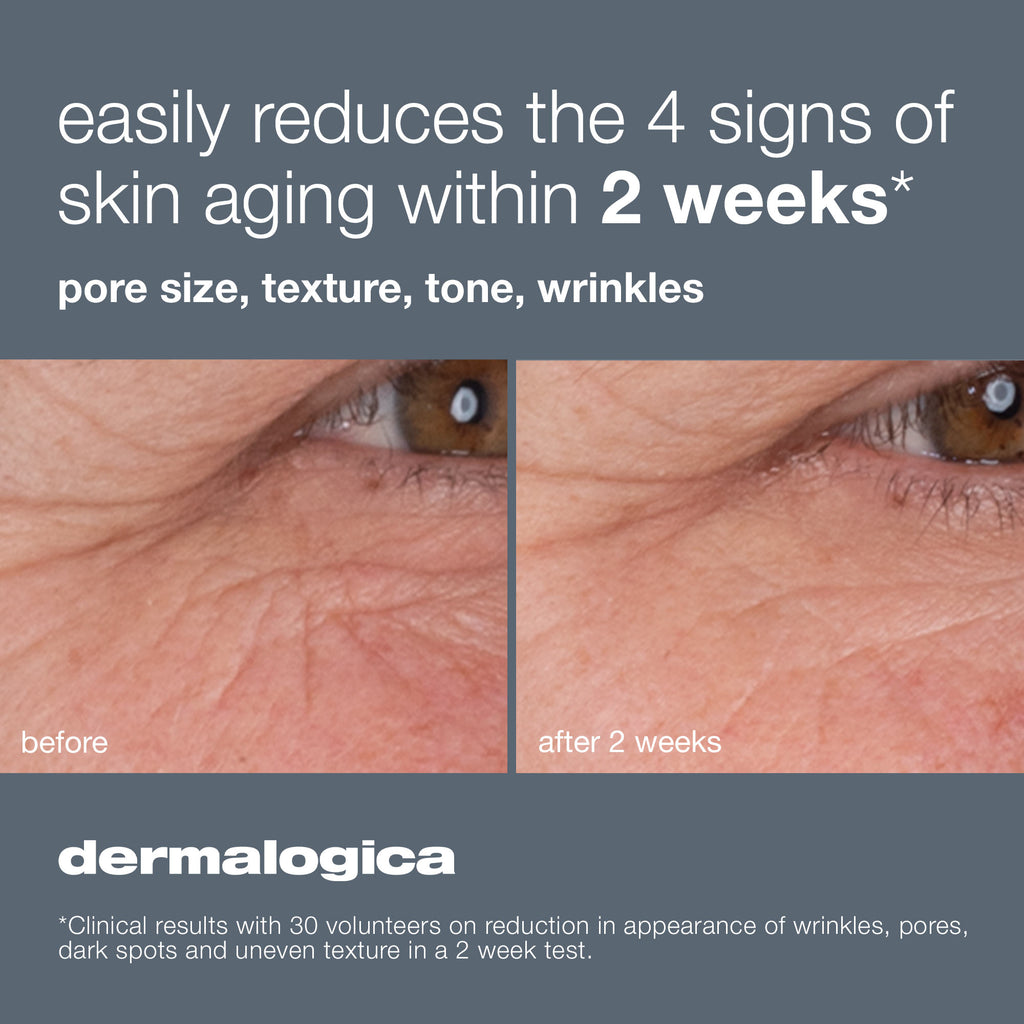 Dynamic-Skin-Retinol-Serum-Dermalogica-before-And-after