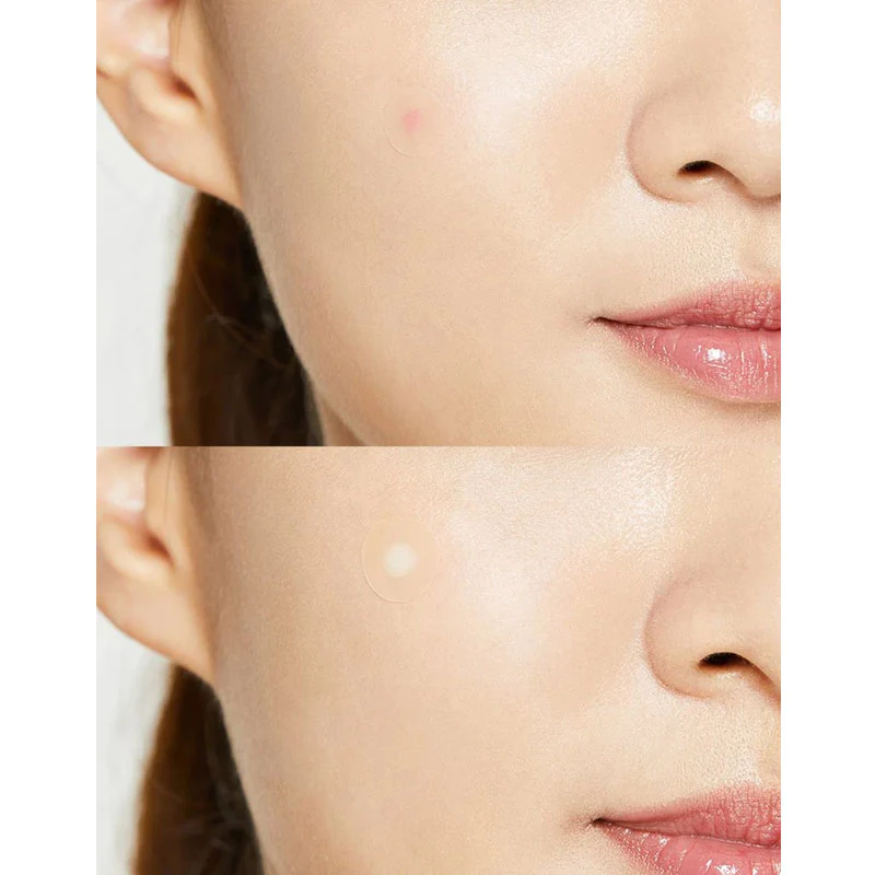 cosrx-acne-pimple-master-patch.