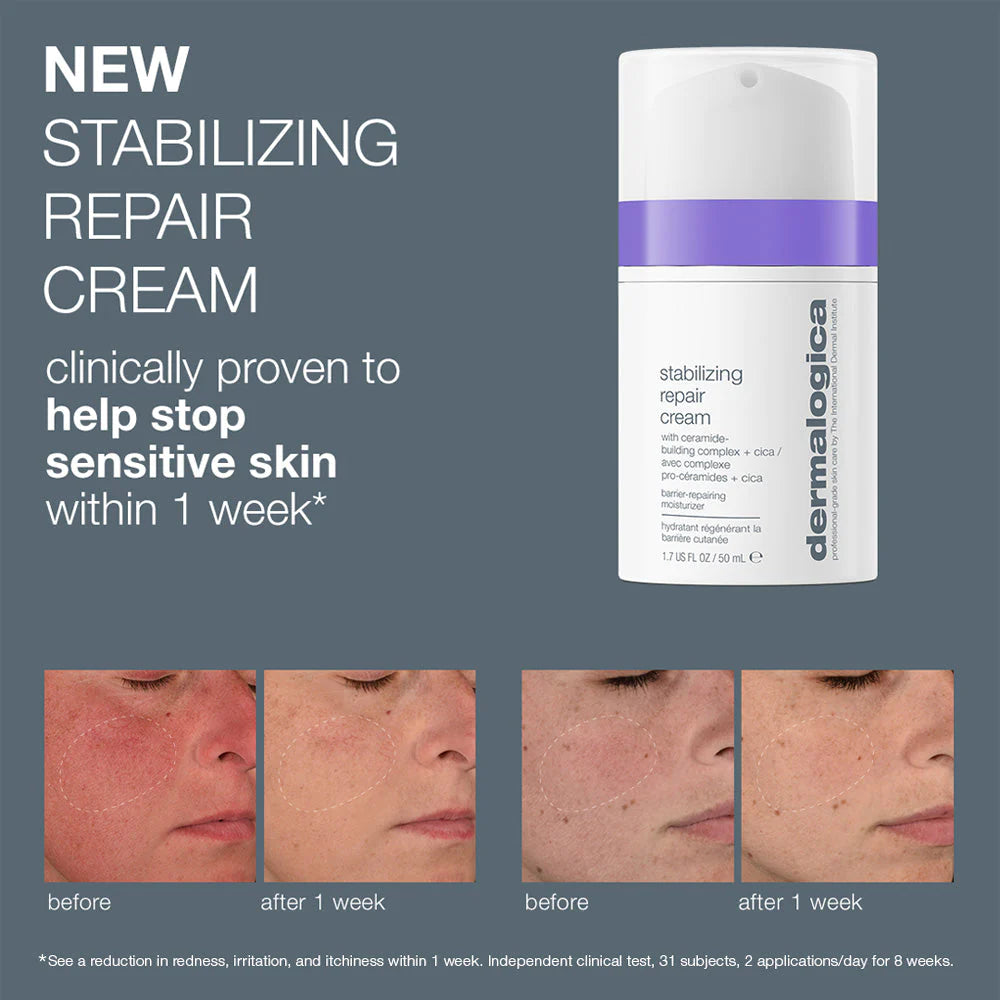 dermalogica-stabilizing-repair-cream-before-and-after
