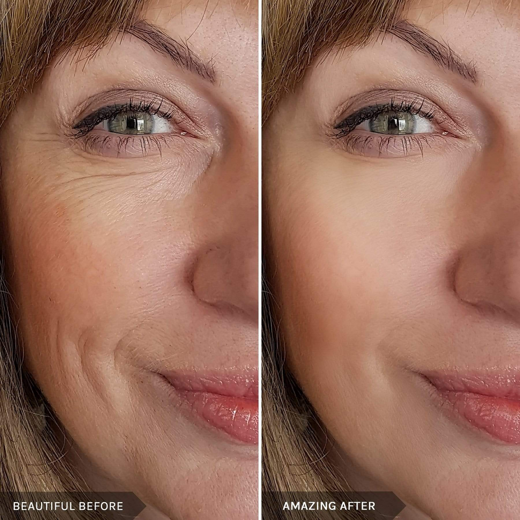 mirenesse-makeup-boosters-instant-fill-glowing-skin-duo-before-after