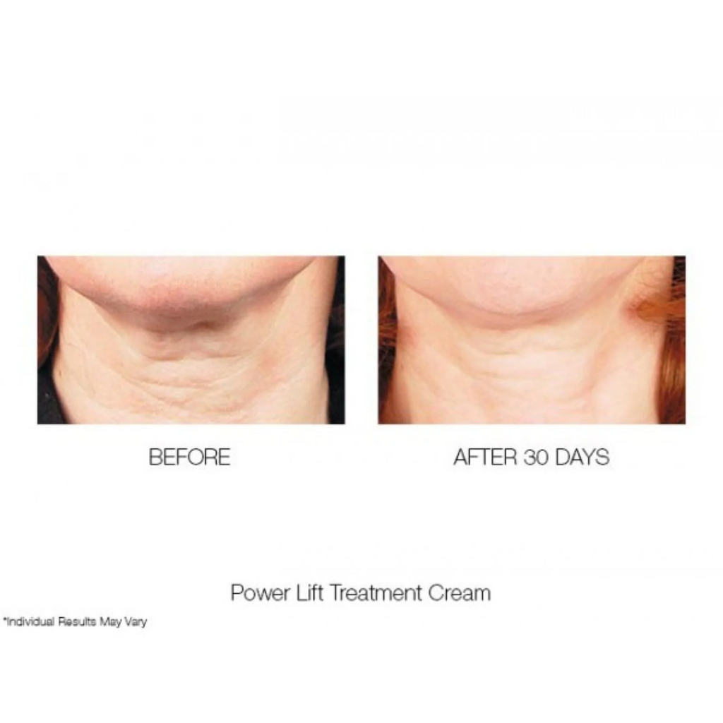 mirenesse-power-lift-treatment-cream-moisturiser-before-after
